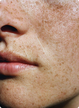 Hormone Optimization