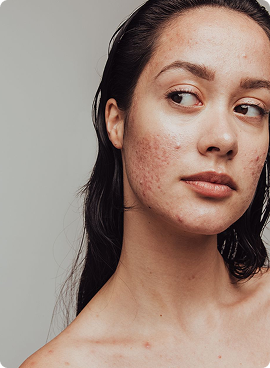 Stress & Sleep Management