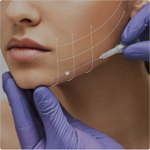 Utilizing biocompatible, absorbable threads expertly placed under your skin, this advanced procedure gently lifts sagging tissues, stimulates collagen production, and enhances overall facial and body contours.