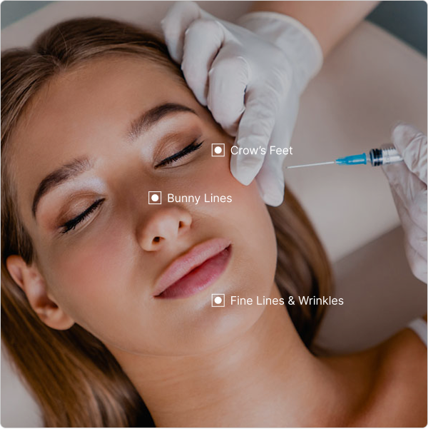 This FDA-approved, scientifically validated approach gently blocks signals causing muscle contractions, preventing wrinkles from deepening further.