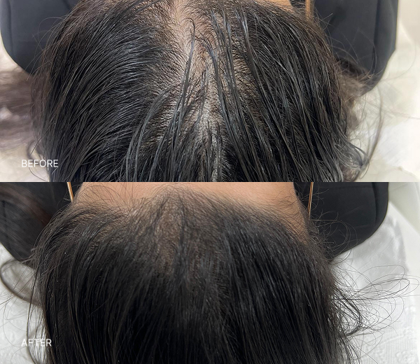 What NAD+ Therapy Can Help With