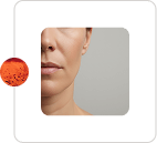 Non-Invasive Skin Tightening