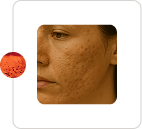 Collagen Stimulation