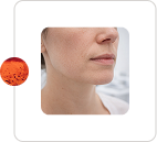 Fix Fine Lines and Wrinkles