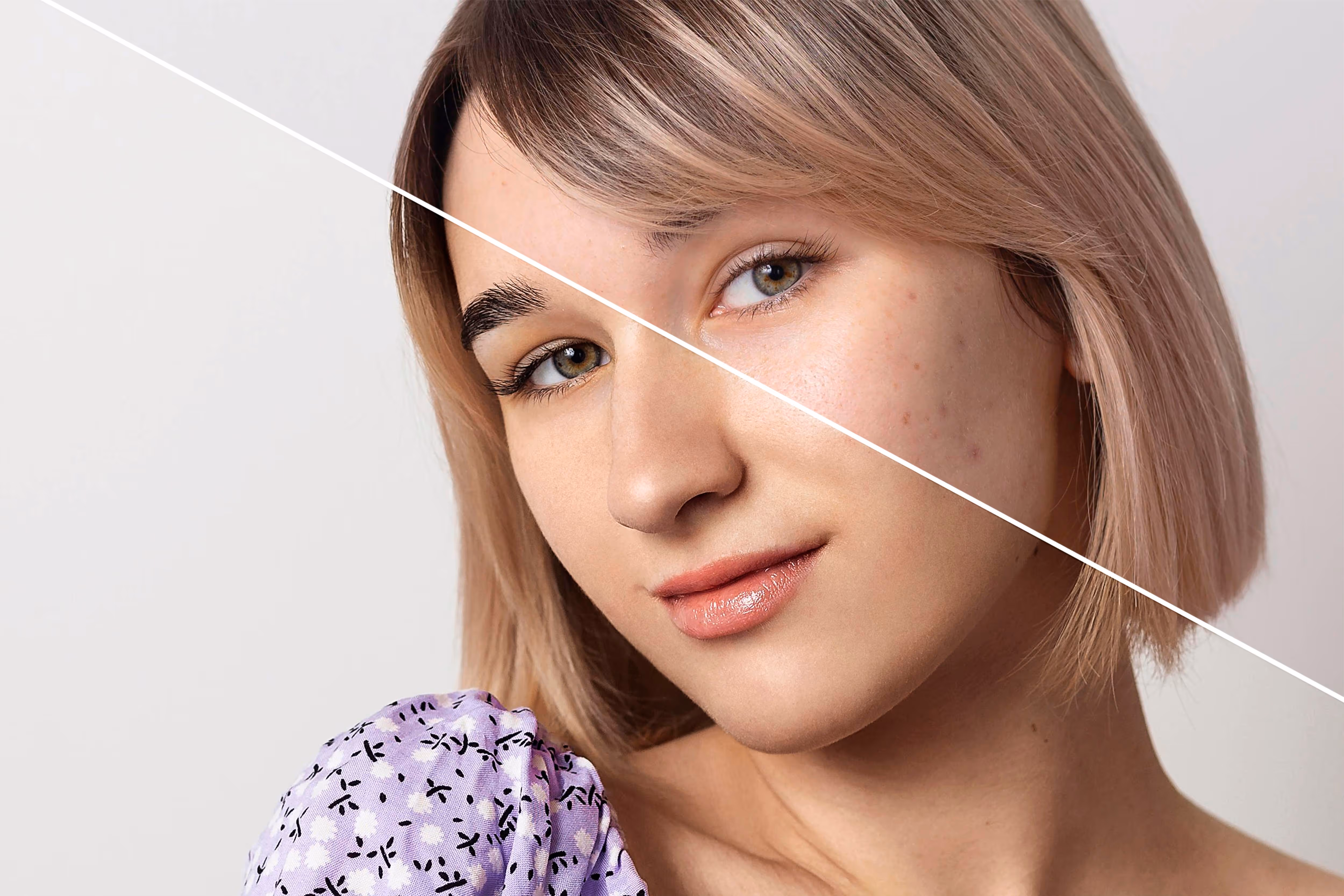 Skin Booster Treatment Areas