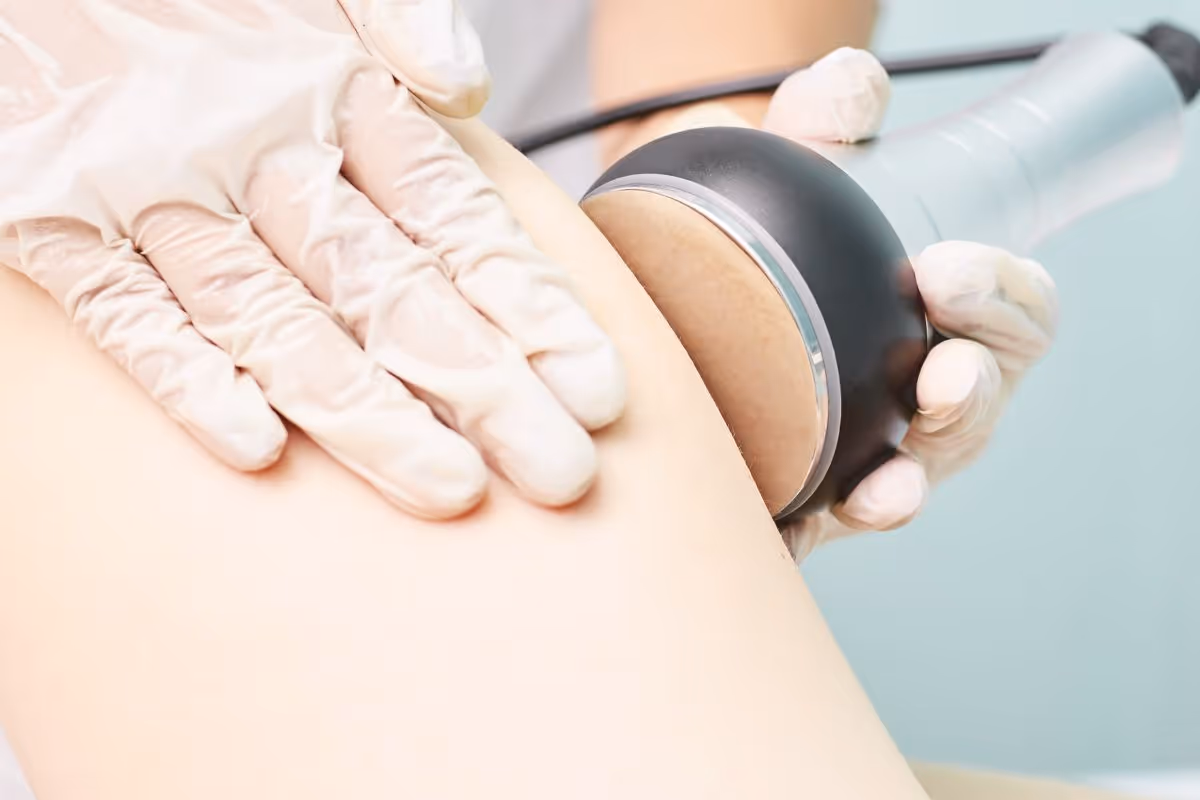 How Does Cavitation Treatment Compare to Other Body Contouring Methods?	