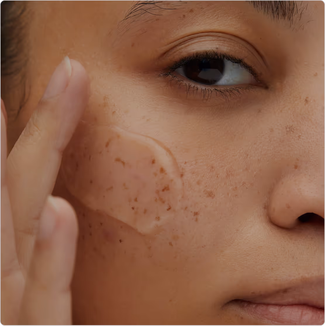 Face Rejuvenation & Anti Ageing