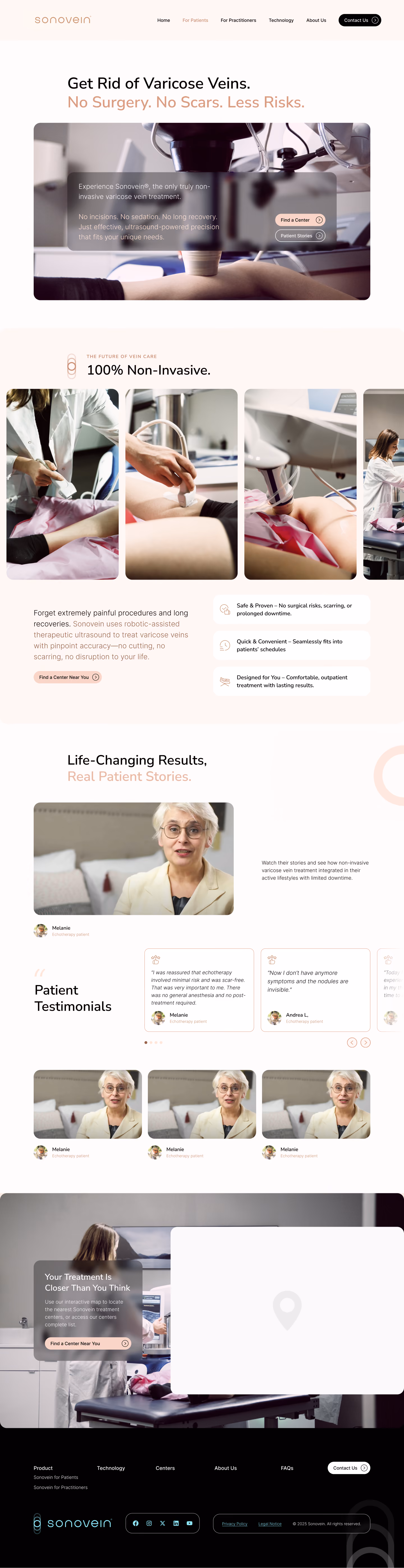 Full-page screenshot of the Sonovein page for patients