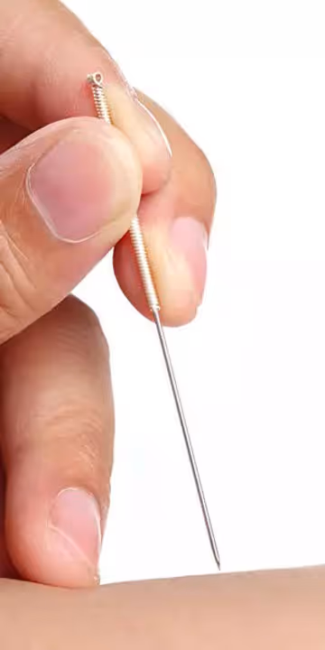 dry needling physical & physical therapy