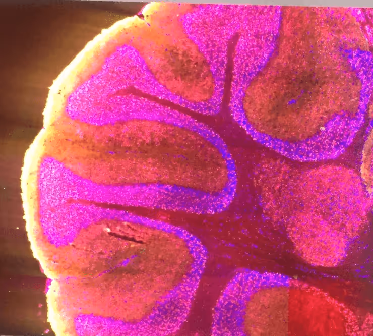 Microscopic view of a tissue cross-section stained in bright pink, purple, and red hues with branching patterns.