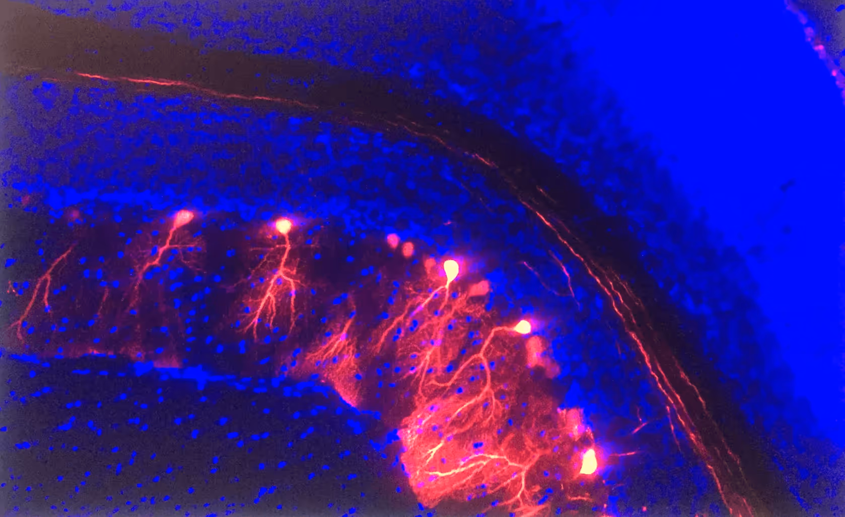 Microscopic view of neurons glowing red with blue-stained surrounding cells in neural tissue.