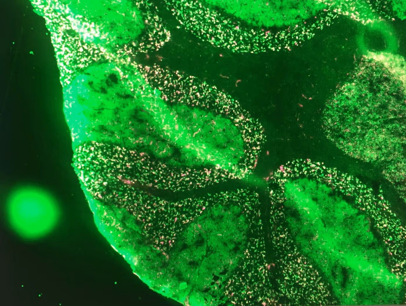 Microscopic view of cells stained bright green with scattered smaller glowing pink spots.