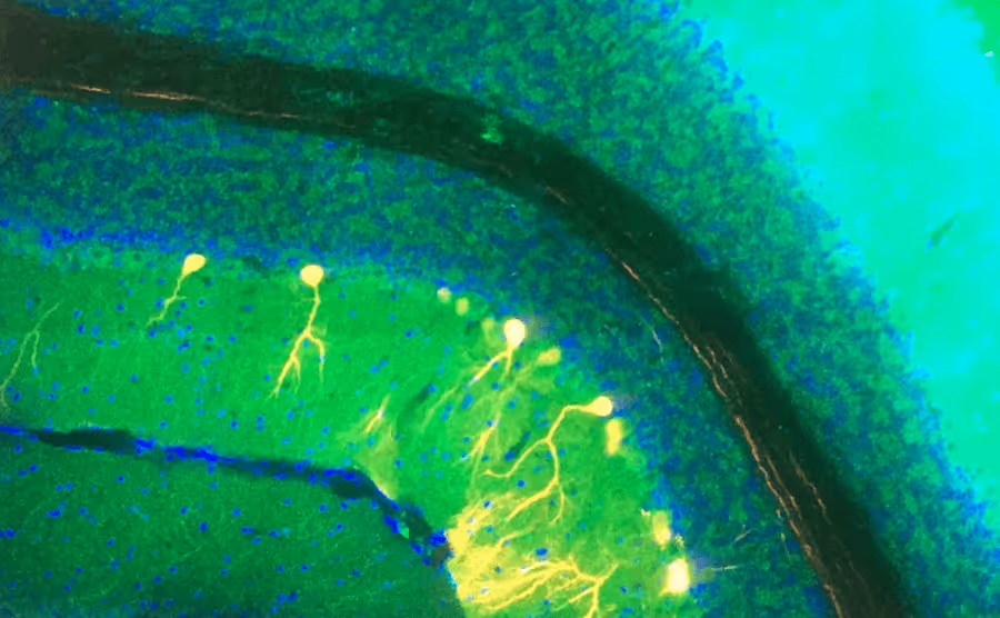 Microscopic image of brain tissue showing brightly glowing neurons with branching dendrites in green and blue hues.