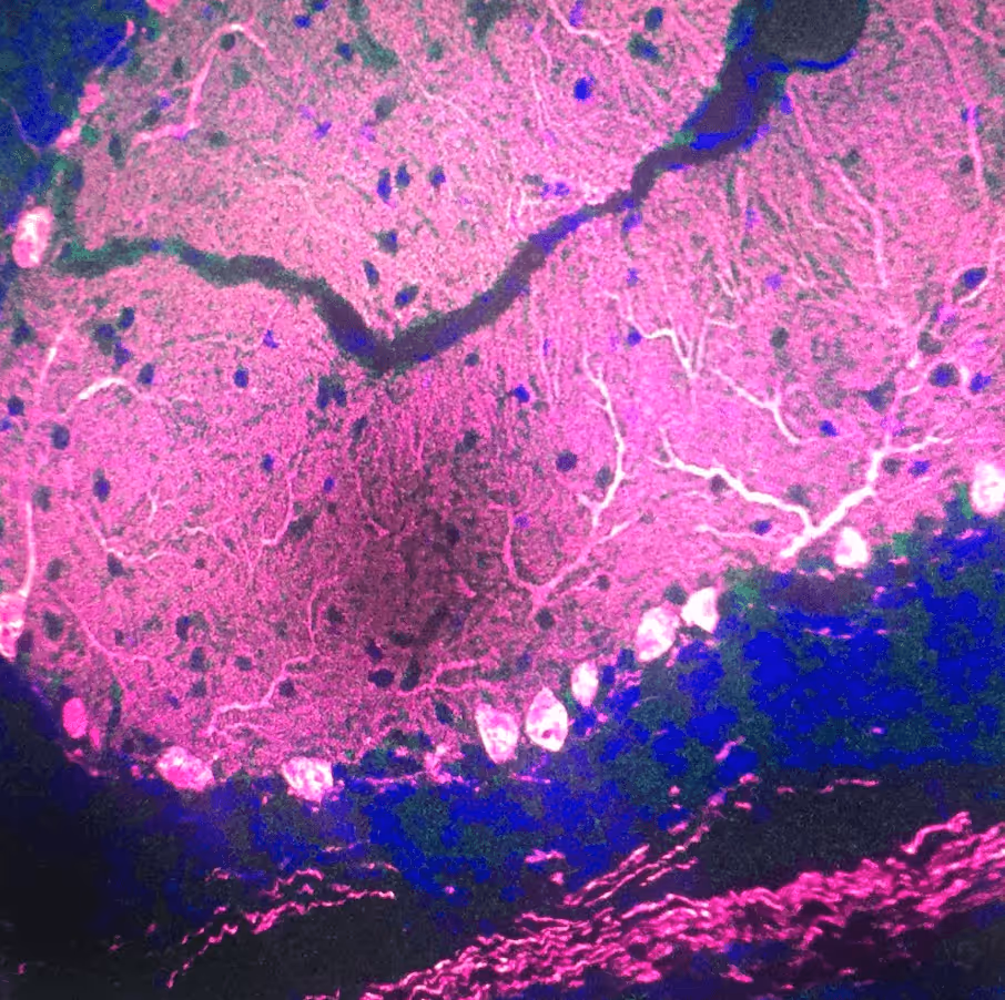 Microscopic view of pink stained tissue cells with visible nuclei and branching structures under a microscope.