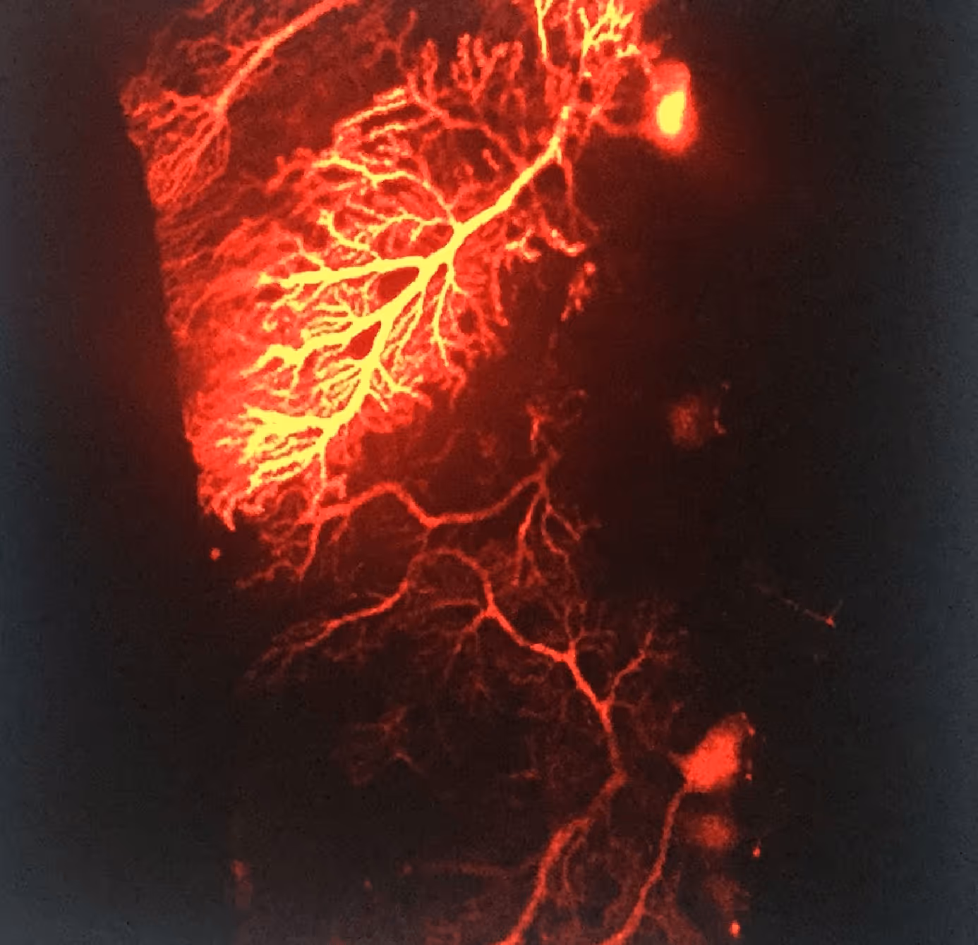 Bright red illuminated branching network resembling blood vessels or nerve fibers on dark background.