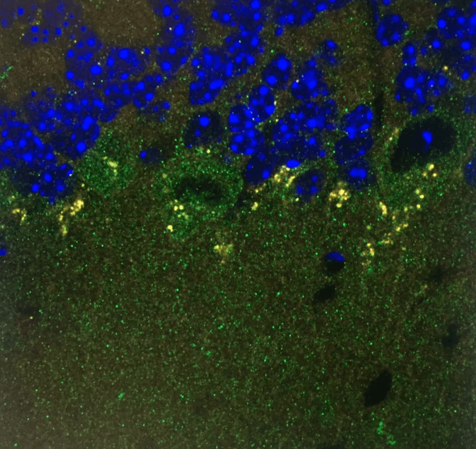 Microscopic view of cells with blue nuclei and green and yellow fluorescent markers in tissue sample.