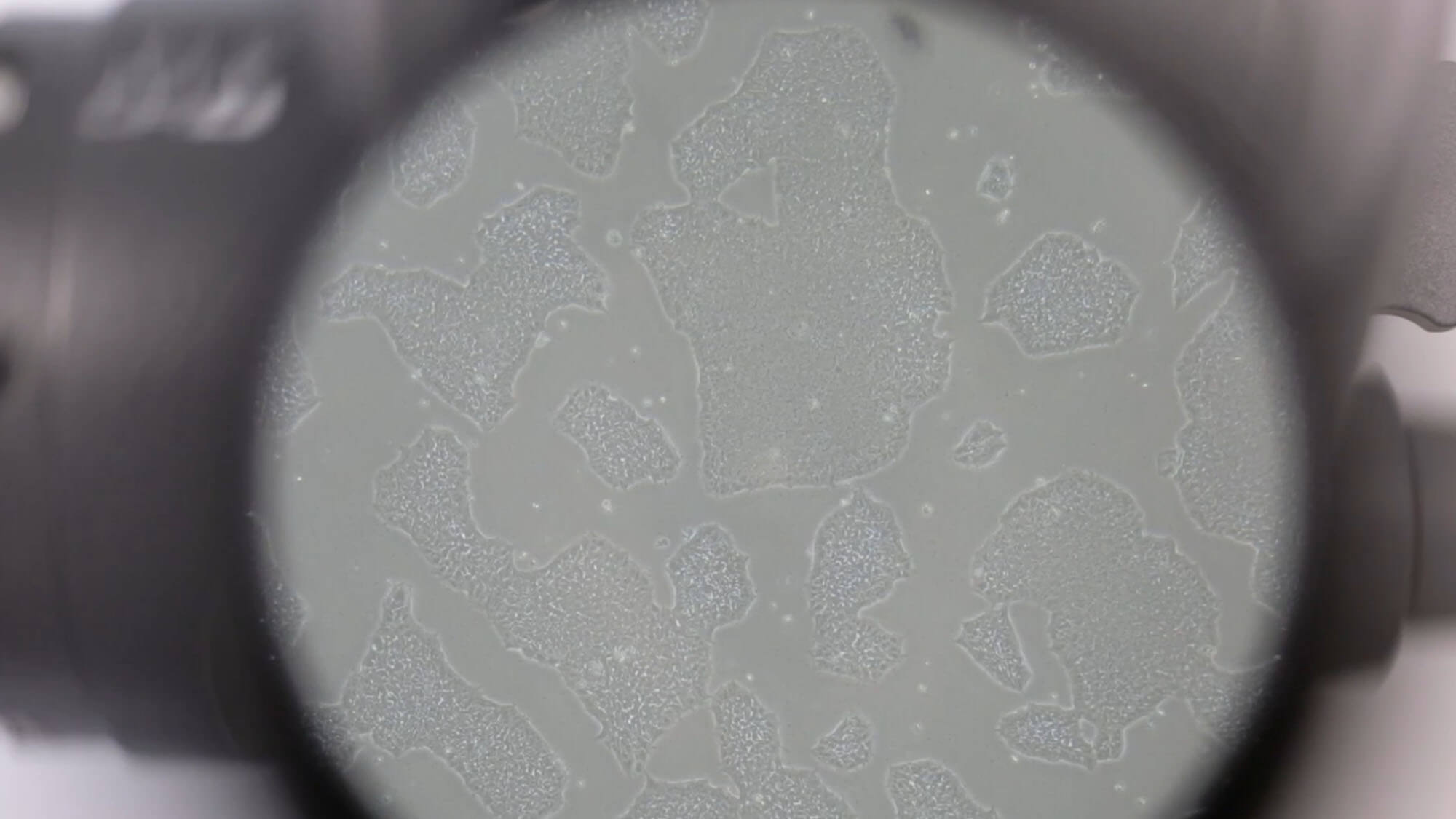 Human induced pluripotent stem cells through a microscope