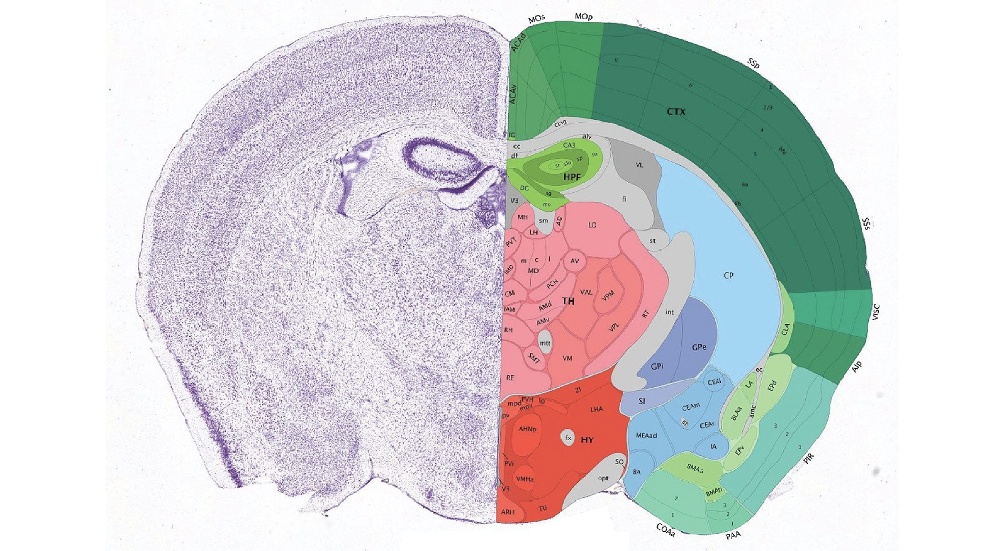 Brain cross-section with anatomical regions labeled including cortex, thalamus, hippocampus, and cerebellum.