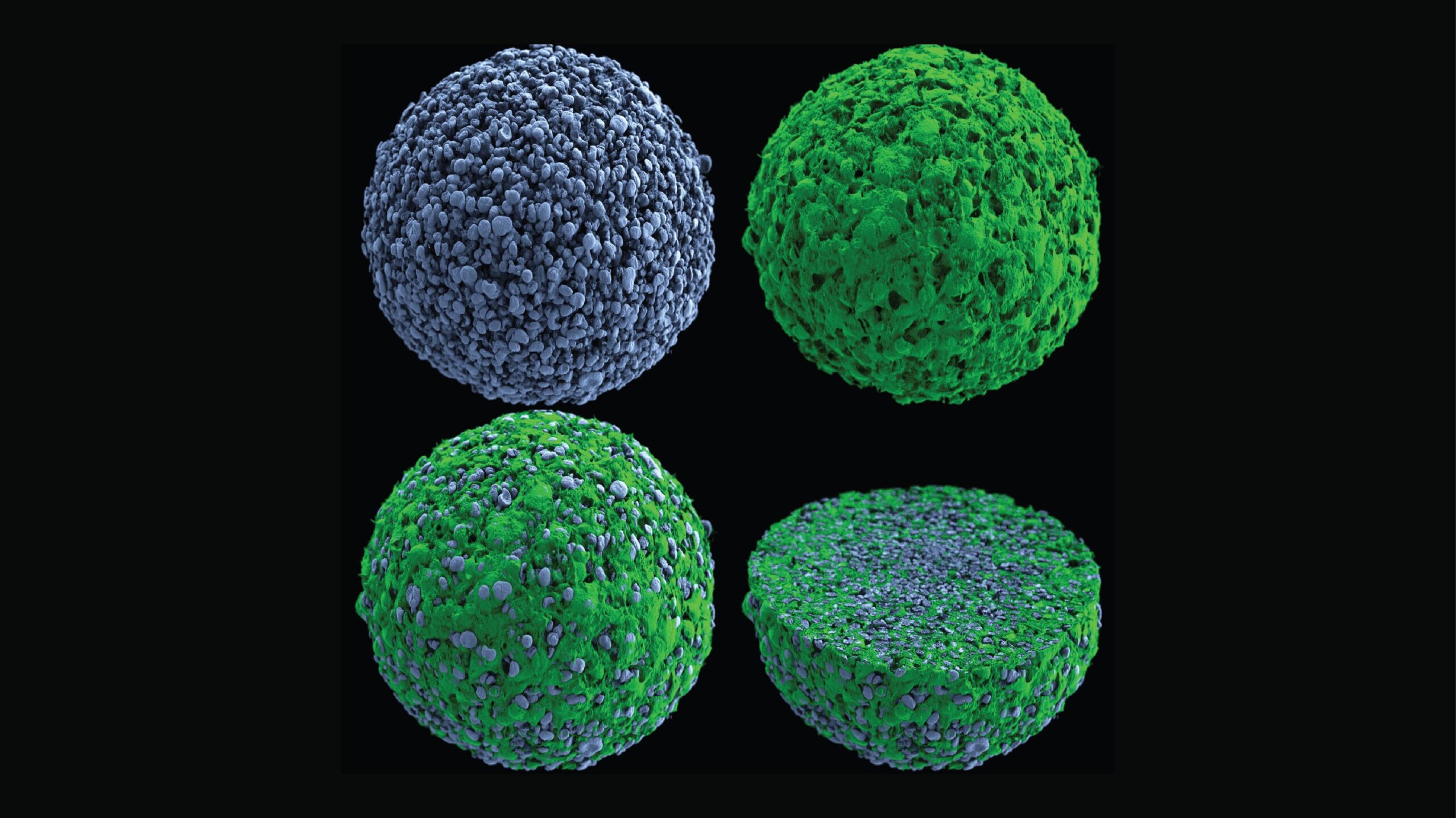 Scientists are using tumor “spheroids” to study glioblastoma, a deadly brain cancer