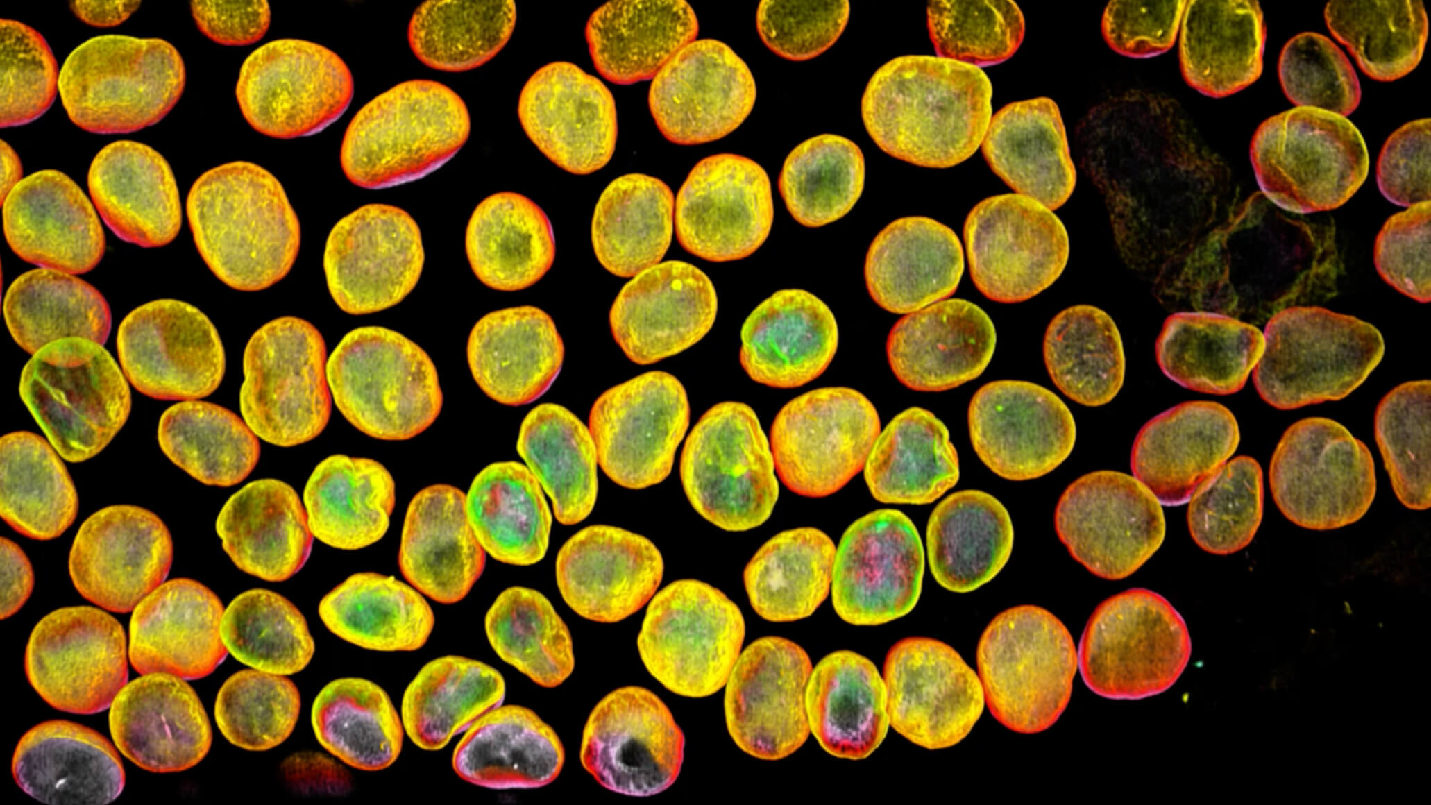 Microscopic view of colorful bacterial cells with yellow, orange, and red fluorescent membranes