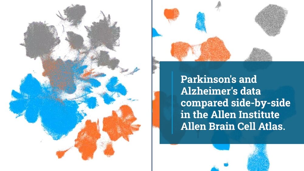 Brain cell atlas comparing Parkinson's and Alzheimer's disease data visualizations in blue and orange