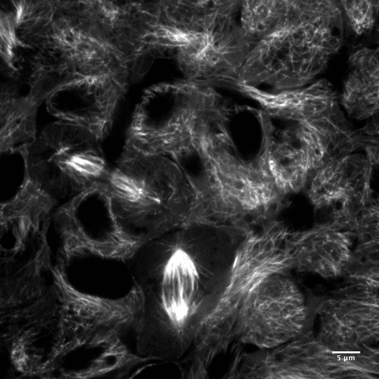Microscopic black and white image showing cellular structures with bright fibrous networks and dark void spaces.