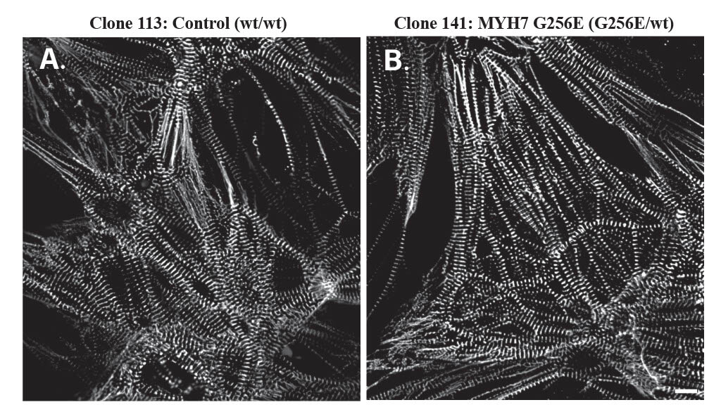 Microscopic comparison of Clone 113 control versus Clone 141 MYH7 G256E mutation tissue structure