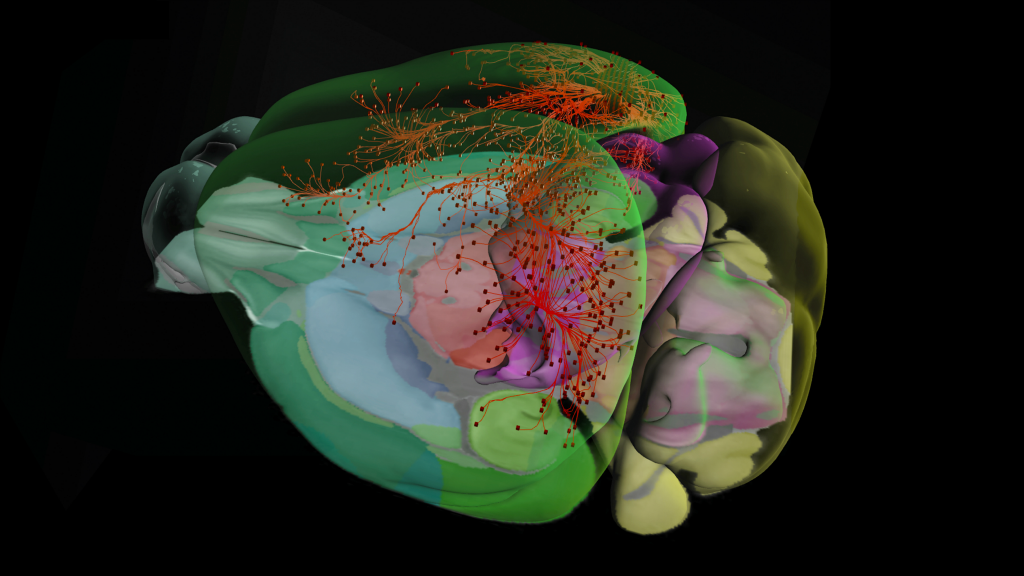 Colorful 3D brain model with green, blue, red, and yellow regions showing neural connections and pathways