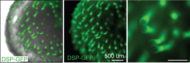 Three fluorescence microscopy images of DSP-GFP protein expression in cells at different magnifications.