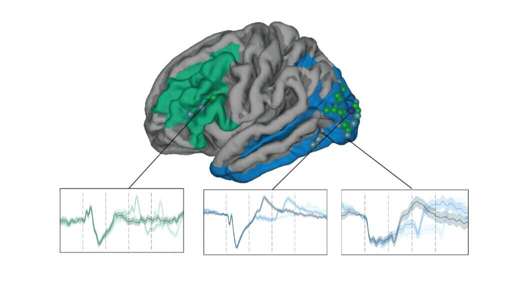 Brain diagram showing green and blue highlighted regions with three corresponding neural activity graphs below