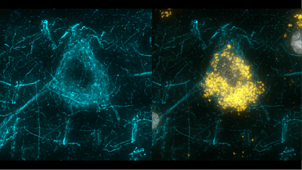 Fluorescent microscopy comparison showing cyan and yellow highlighted cellular or neural network structures