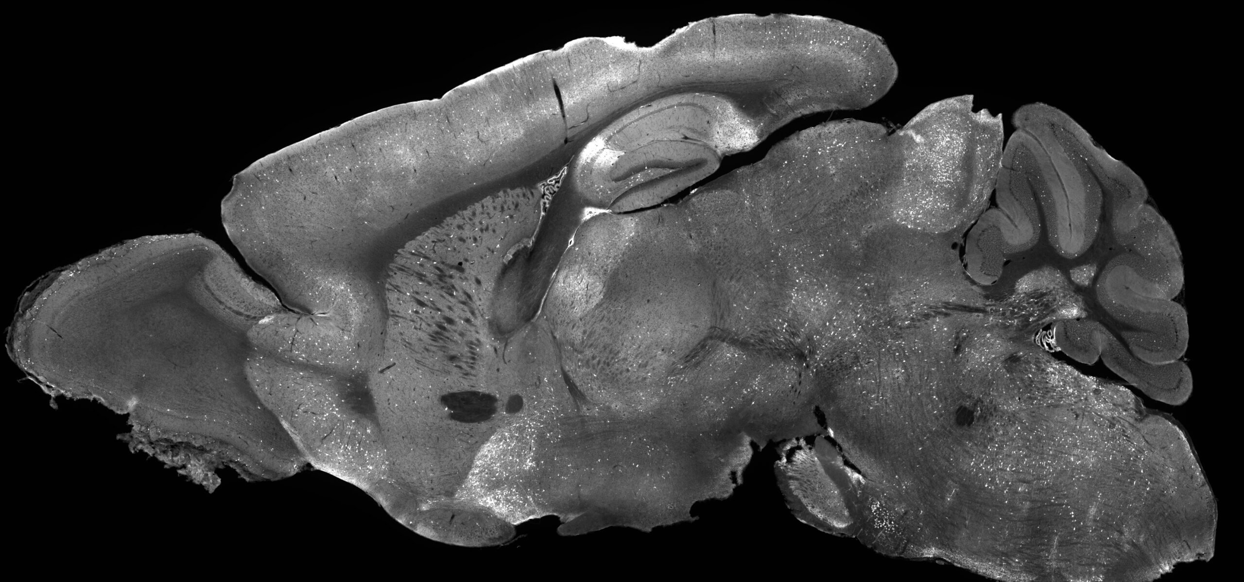 Microscopic organism or sea creature photographed in grayscale with detailed surface texture