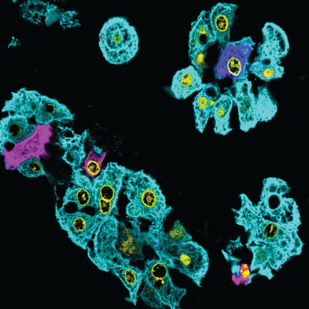 Fluorescent microscopy image of cells with cyan cytoplasm, yellow nuclei, and purple-stained organelles on black background.