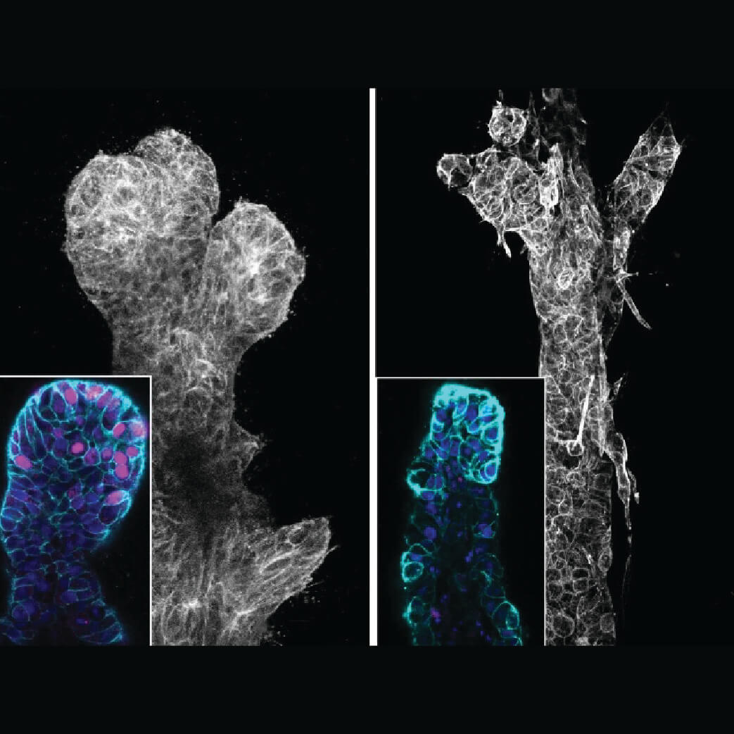 Microscopic imaging of plant tissues showing detailed cellular structures with fluorescent and grayscale visualization.