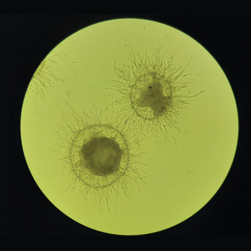 Microscopic view of two circular organisms with radiating hair-like structures on yellow background