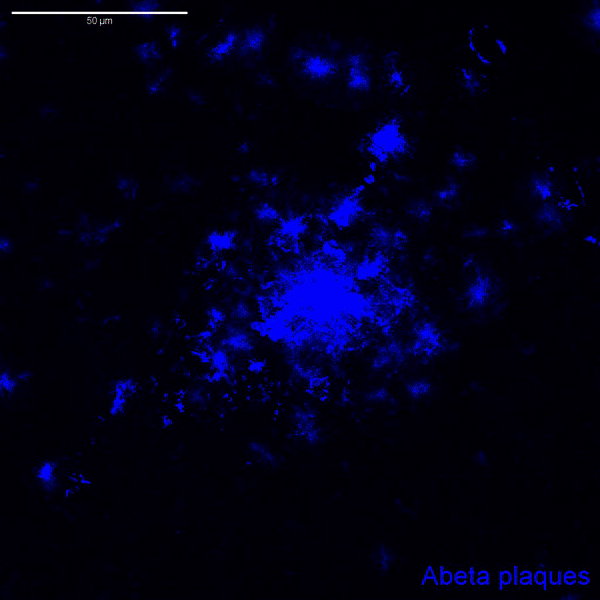 Fluorescent microscopy image showing blue Abeta plaques aggregates on black background with scale bar