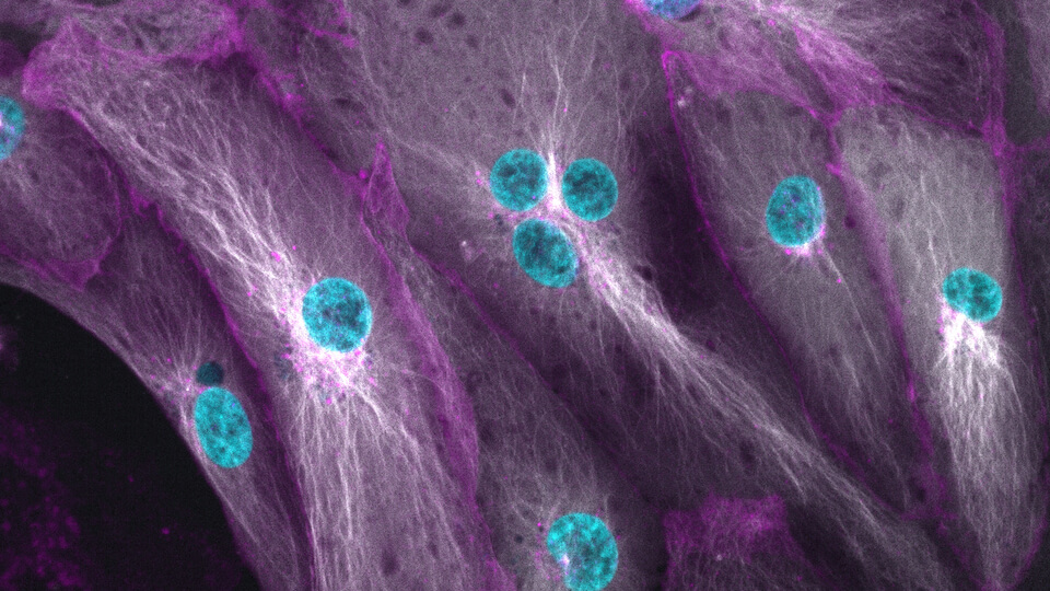 Fluorescent microscopy showing cells with cyan nuclei and purple filament network structures