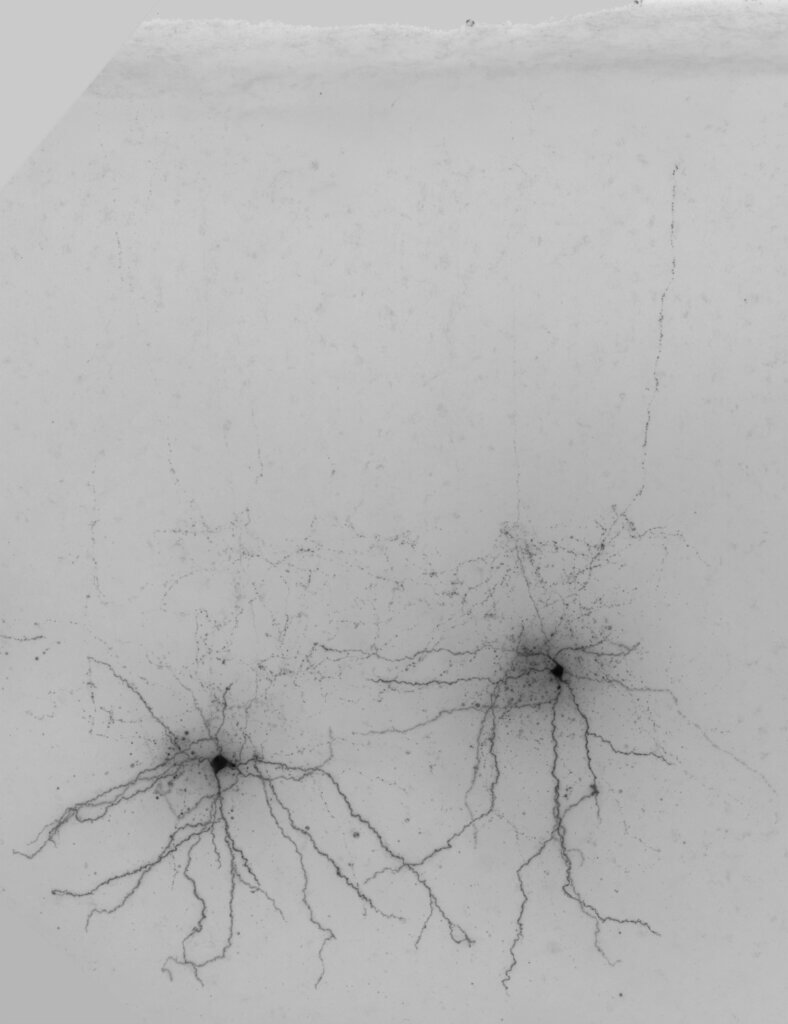 Two SST met-type 7 neurons sit in lower layers of the mouse cortex.