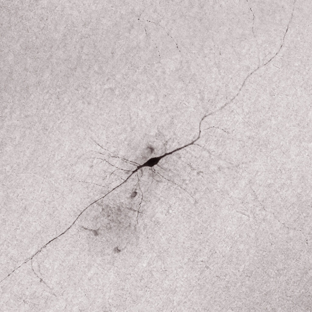 The von Economo neuron is a large and distinct looking brain cell that has been found in only a few animals, including humans.