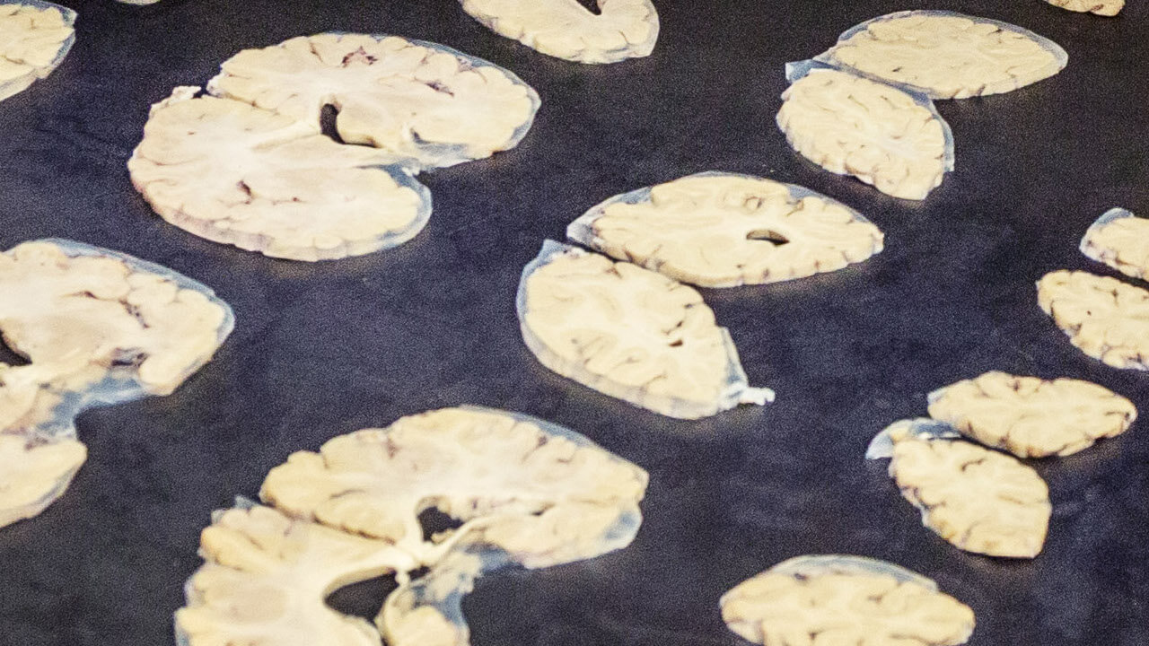 Chocolate chip cookies baking on dark baking sheet or parchment paper.