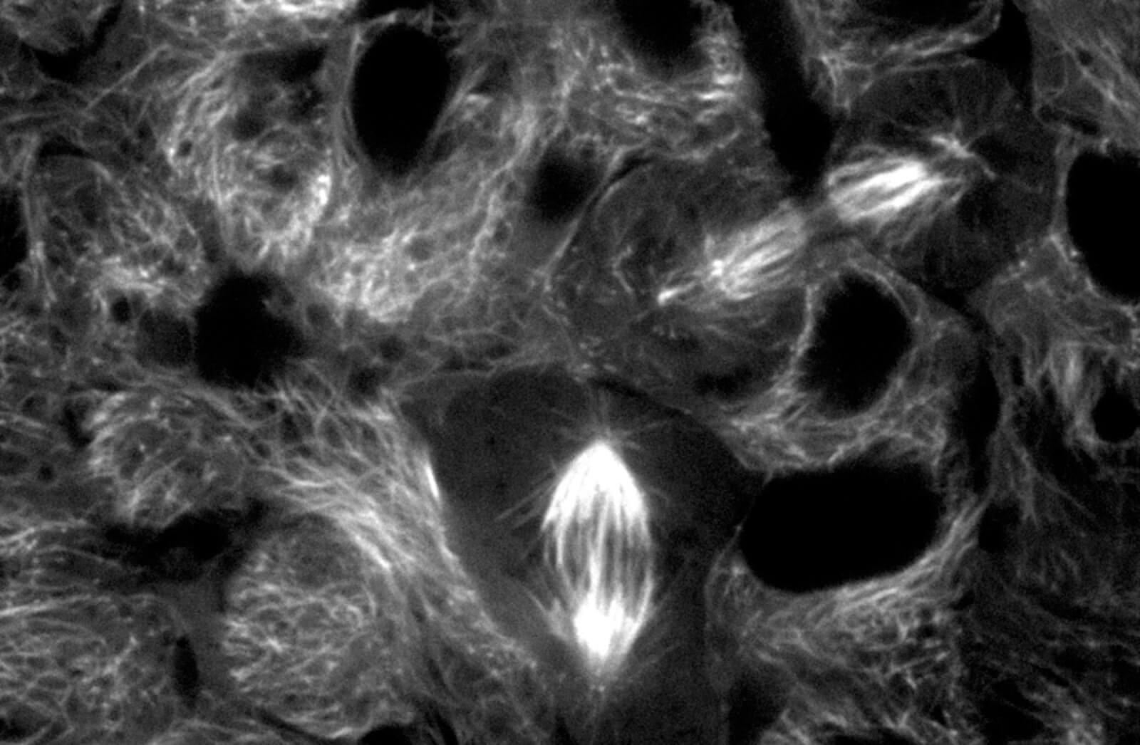 Microscopic view of cells with fibrous cytoplasm and dark nuclei