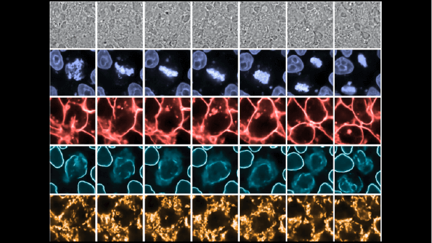 Grid of five microscopy imaging rows showing cellular structures with different fluorescent stains