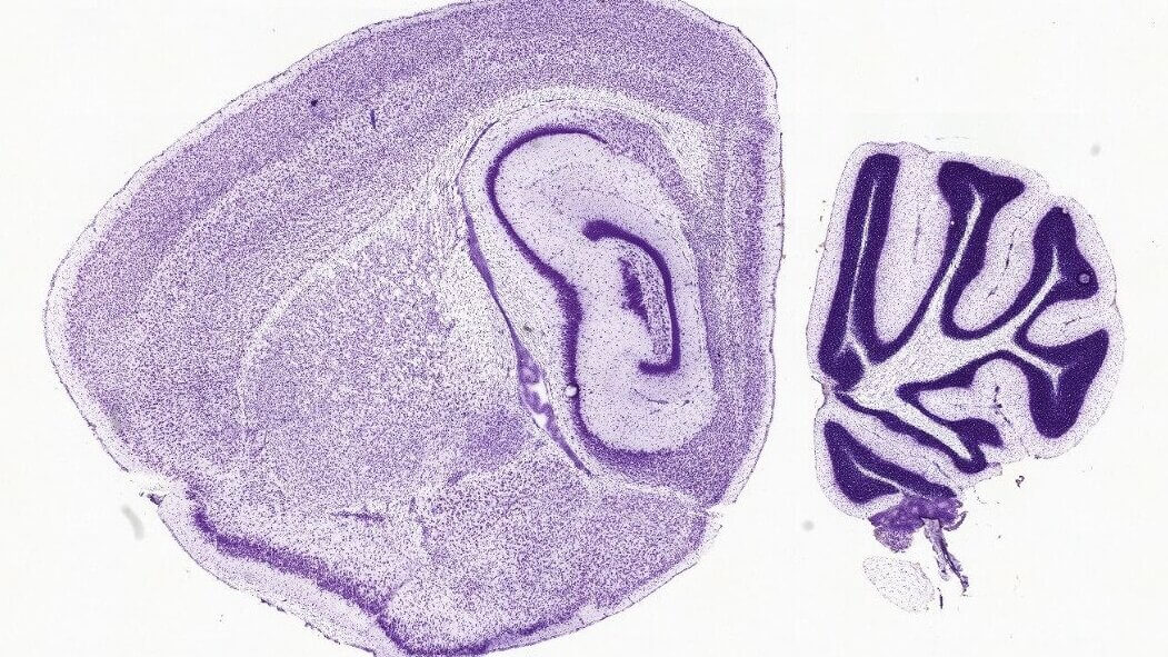Histological cross-section of human ear and cerebellum tissue stained with purple dye