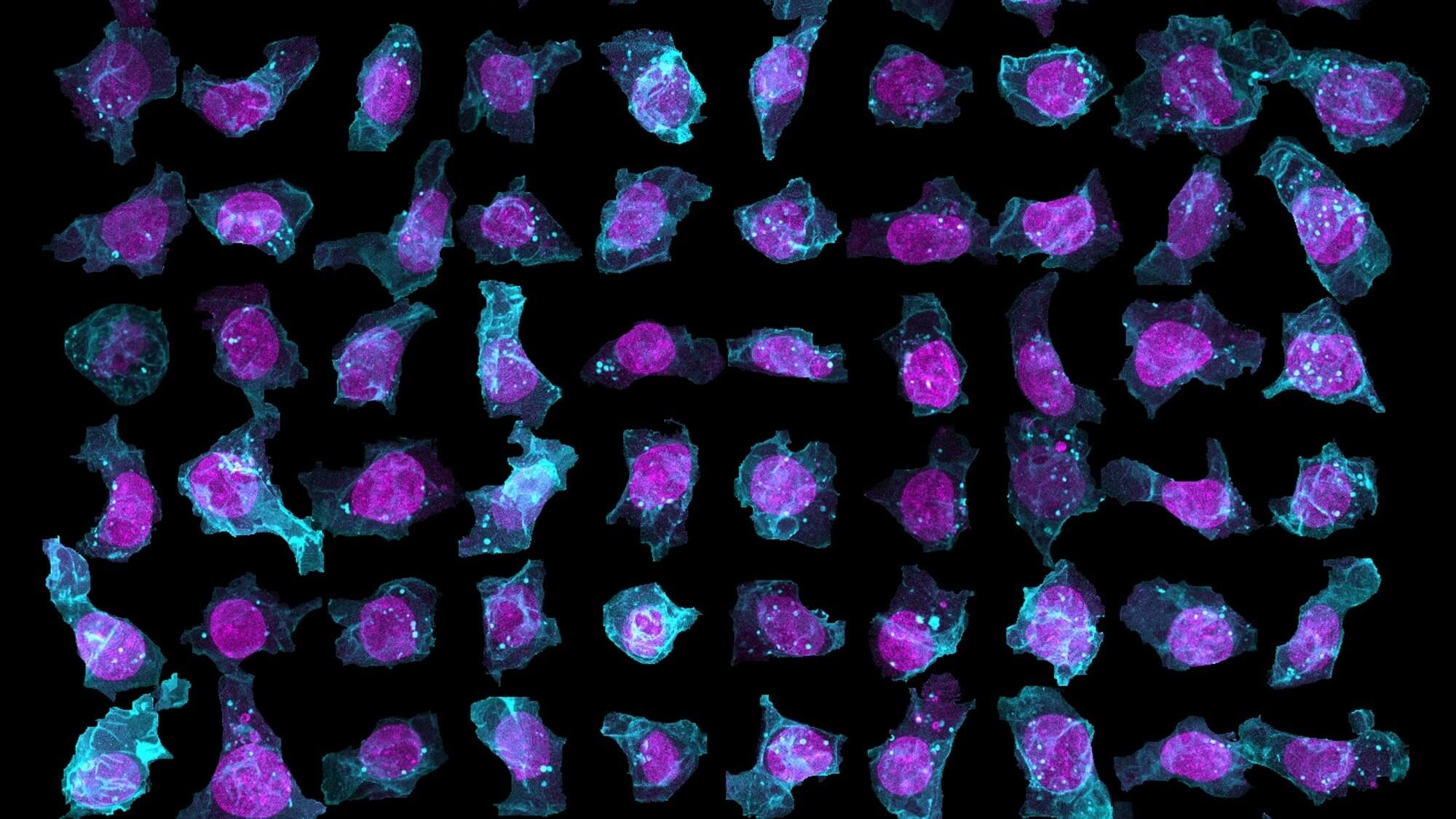 Microscopic fluorescent cells with magenta nuclei and cyan cytoplasm on black background
