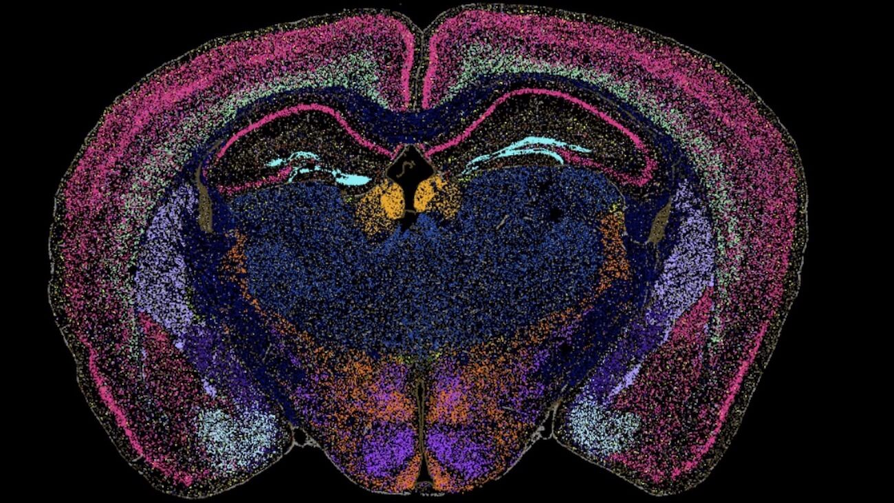Colorful cross-section of a mouse brain showing neural tissue with pink, blue, and orange regions.