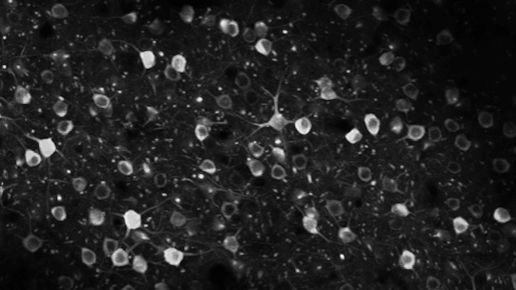 Black and white microscopic view of interconnected cells and particles in dark space