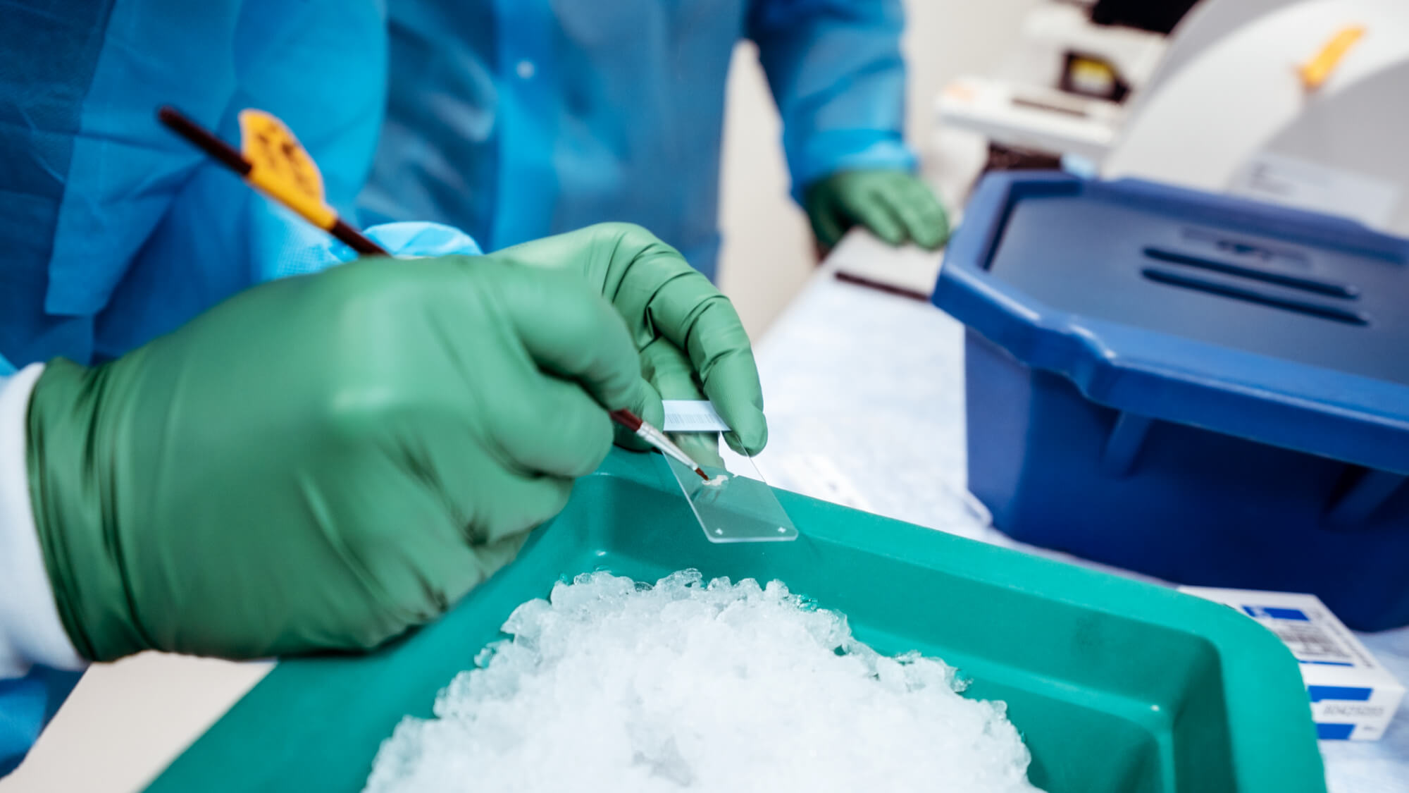 Scientist in green gloves preparing biological sample on ice in laboratory setting