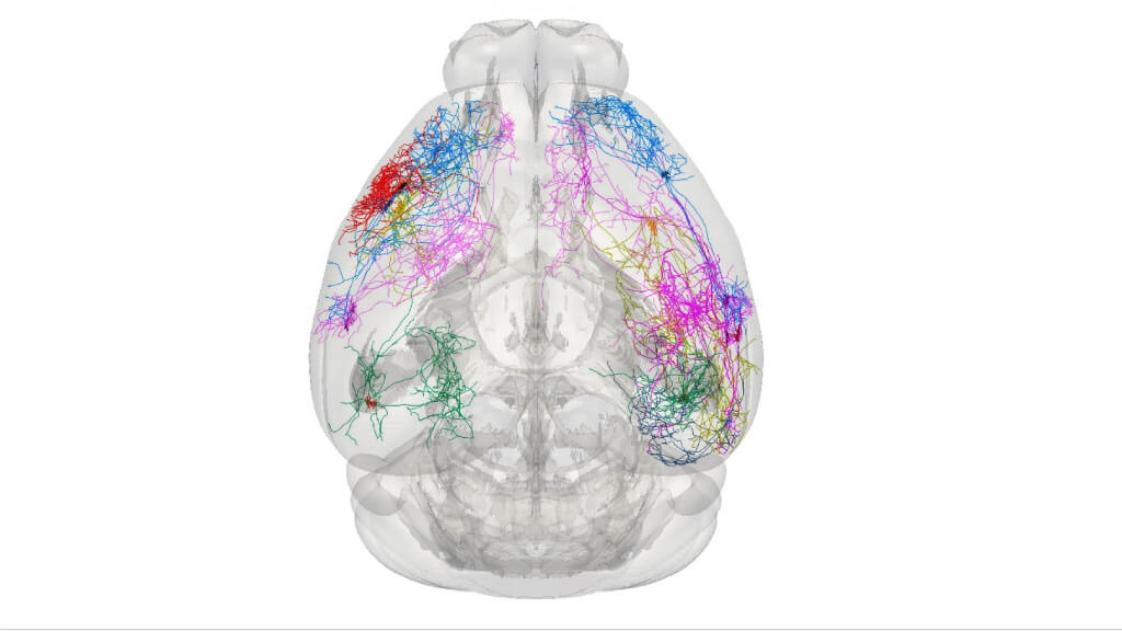 3D brain illustration showing colorful neural pathways and anatomical structure from bottom view