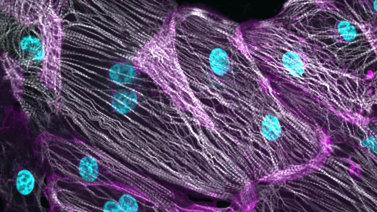 Fluorescent microscopy image showing cells with purple membranes and cyan nuclei