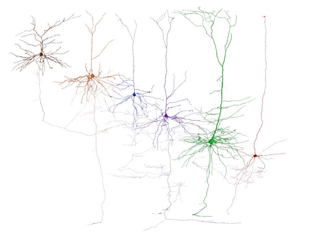 Neural network visualization showing interconnected nodes in brown, blue, purple, and green colors